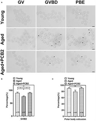 Procyanidin B2 Protects Aged Oocytes Against Meiotic Defects Through Cortical Tension Modulation